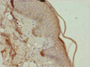 Immunohistochemistry of paraffin-embedded human skin tissue using CSB-PA618875ESR1HU at dilution of 1:100