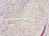 Immunohistochemistry of paraffin-embedded human tonsil tissue using CSB-PA618875ESR1HU at dilution of 1:100