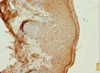 Immunohistochemistry of paraffin-embedded human skin tissue using CSB-PA618875ESR2HU at dilution of 1:100