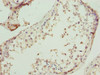 Immunohistochemistry of paraffin-embedded human testis tissue using CSB-PA851532ESR1HU at dilution of 1:100