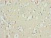 Immunohistochemistry of paraffin-embedded human brain tissue using CSB-PA025420ESR1HU at dilution of 1:100