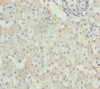 Immunohistochemistry of paraffin-embedded human liver tissue using CSB-PA852773ESR1HU at dilution of 1:100