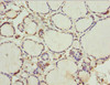 Immunohistochemistry of paraffin-embedded human thyroid tissue using CSB-PA026035ESR1HU at dilution of 1:100