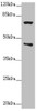 Western blot<br />
 All lanes: POC1A antibody at 2.76µg/ml + Raji whole cell lysate<br />
 Secondary<br />
 Goat polyclonal to rabbit IgG at 1/10000 dilution<br />
 Predicted band size: 46, 40, 41 kDa<br />
 Observed band size: 46, 70 kDa<br />