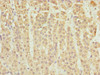 Immunohistochemistry of paraffin-embedded human adrenal gland tissue using CSB-PA867198ESR2HU at dilution of 1:100