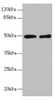 Western blot<br />
 All lanes: ZBTB25 antibody at 1.41µg/ml<br />
 Lane 1: MCF-7 whole cell lysate<br />
 Lane 2: Hela whole cell lysate<br />
 Secondary<br />
 Goat polyclonal to rabbit IgG at 1/10000 dilution<br />
 Predicted band size: 49 kDa<br />
 Observed band size: 49 kDa<br />