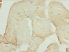 Immunohistochemistry of paraffin-embedded human skeletal muscle tissue using CSB-PA026322ESR1HU at dilution of 1:100