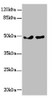 Western blot<br />
 All lanes: ZBTB25 antibody at 0.43µg/ml<br />
 Lane 1: MCF-7 whole cell lysate<br />
 Lane 2: Hela whole cell lysate<br />
 Secondary<br />
 Goat polyclonal to rabbit IgG at 1/10000 dilution<br />
 Predicted band size: 49 kDa<br />
 Observed band size: 49 kDa<br />