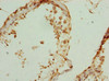 Immunohistochemistry of paraffin-embedded human testis tissue using CSB-PA026322ESR2HU at dilution of 1:100
