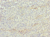 Immunohistochemistry of paraffin-embedded human spleen tissue using CSB-PA026340DSR1HU at dilution of 1:100