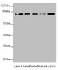 Western blot<br />
 All lanes: ZBTB48 antibody at 0.31µg/ml<br />
 Lane 1: 293T whole cell lysate<br />
 Lane 2: K562 whole cell lysate<br />
 Lane 3: HepG2 whole cell lysate<br />
 Lane 4: U251 whole cell lysate<br />
 Lane 5: Mouse liver tissue<br />
 Secondary<br />
 Goat polyclonal to rabbit IgG at 1/10000 dilution<br />
 Predicted band size: 77 kDa<br />
 Observed band size: 77 kDa<br />