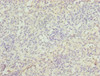 Immunohistochemistry of paraffin-embedded human spleen tissue using CSB-PA026340DSR2HU at dilution of 1:100