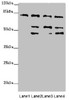 Western blot<br />
 All lanes: ZFYVE1 antibody at 6.89µg/ml<br />
 Lane 1: Hela whole cell lysate<br />
 Lane 2: 293T whole cell lysate<br />
 Lane 3: Mouse liver tissue<br />
 Lane 4: Mouse kidney tissue<br />
 Secondary<br />
 Goat polyclonal to rabbit IgG at 1/10000 dilution<br />
 Predicted band size: 88, 41, 86 kDa<br />
 Observed band size: 81, 54, 47 kDa<br />