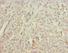 Immunohistochemistry of paraffin-embedded human pancreatic tissue using CSB-PA064019ESR1HU at dilution of 1:100