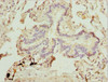 Immunohistochemistry of paraffin-embedded human lung tissue using CSB-PA064019ESR2HU at dilution of 1:100