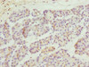 Immunohistochemistry of paraffin-embedded human pancreatic tissue using CSB-PA064019ESR2HU at dilution of 1:100