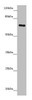 Western blot<br />
 All lanes: ZNF169 antibody at 5.32µg/ml + Hela whole cell lysate<br />
 Secondary<br />
 Goat polyclonal to rabbit IgG at 1/10000 dilution<br />
 Predicted band size: 68 kDa<br />
 Observed band size: 68 kDa<br />