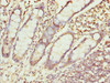 Immunohistochemistry of paraffin-embedded human small intestine tissue using CSB-PA026553ESR2HU at dilution of 1:100