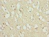 Immunohistochemistry of paraffin-embedded human brain tissue using CSB-PA026570ESR1HU at dilution of 1:100