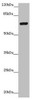 Western blot<br />
 All lanes: ZNF20 antibody at 2.99µg/ml + Mouse kidney tissue<br />
 Secondary<br />
 Goat polyclonal to rabbit IgG at 1/10000 dilution<br />
 Predicted band size: 62 kDa<br />
 Observed band size: 62 kDa<br />