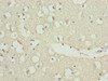 Immunohistochemistry of paraffin-embedded human brain tissue using CSB-PA026622ESR1HU at dilution of 1:100