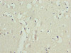 Immunohistochemistry of paraffin-embedded human brain tissue using CSB-PA026622ESR2HU at dilution of 1:100