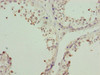 Immunohistochemistry of paraffin-embedded human testis tissue using CSB-PA026622ESR2HU at dilution of 1:100