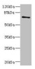 Western blot<br />
 All lanes: ZNF549 antibody at 1.09µg/ml + A549 whole cell lysate<br />
 Secondary<br />
 Goat polyclonal to rabbit IgG at 1/10000 dilution<br />
 Predicted band size: 75, 73 kDa<br />
 Observed band size: 75 kDa<br />