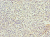 Immunohistochemistry of paraffin-embedded human spleen tissue using CSB-PA836696ESR2HU at dilution of 1:100