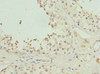 Immunohistochemistry of paraffin-embedded human testis tissue using CSB-PA623012ESR1HU at dilution of 1:100