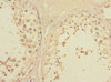 Immunohistochemistry of paraffin-embedded human testis tissue using CSB-PA839868ESR1HU at dilution of 1:100