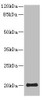 Western blot<br />
 All lanes: PPP3R2 antibody at 9.25µg/ml + Mouse brain tissue<br />
 Secondary<br />
 Goat polyclonal to rabbit IgG at 1/10000 dilution<br />
 Predicted band size: 20 kDa<br />
 Observed band size: 20 kDa<br />