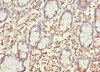 Immunohistochemistry of paraffin-embedded human small intestine tissue using CSB-PA873630ESR2HU at dilution of 1:100