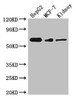 Western Blot<br />
 Positive WB detected in: HepG2 whole cell lysate, MCF-7 whole cell lysate, Mouse kidney tissue<br />
 All lanes: Vangl2 antibody at 3µg/ml<br />
 Secondary<br />
 Goat polyclonal to rabbit IgG at 1/50000 dilution<br />
 Predicted band size: 60 kDa<br />
 Observed band size: 60 kDa<br />