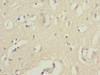 Immunohistochemistry of paraffin-embedded human brain tissue using CSB-PA026142ESR2HU at dilution of 1:100