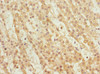 Immunohistochemistry of paraffin-embedded human adrenal gland tissue using CSB-PA026145ESR1HU at dilution of 1:100