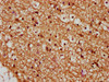 IHC image of CSB-PA026145ESR1HU diluted at 1:245 and staining in paraffin-embedded human brain tissue performed on a Leica BondTM system. After dewaxing and hydration, antigen retrieval was mediated by high pressure in a citrate buffer (pH 6.0) . Section was blocked with 10% normal goat serum 30min at RT. Then primary antibody (1% BSA) was incubated at 4°C overnight. The primary is detected by a biotinylated secondary antibody and visualized using an HRP conjugated SP system.