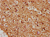 IHC image of CSB-PA026145ESR1HU diluted at 1:245 and staining in paraffin-embedded human brain tissue performed on a Leica BondTM system. After dewaxing and hydration, antigen retrieval was mediated by high pressure in a citrate buffer (pH 6.0) . Section was blocked with 10% normal goat serum 30min at RT. Then primary antibody (1% BSA) was incubated at 4°C overnight. The primary is detected by a biotinylated secondary antibody and visualized using an HRP conjugated SP system.