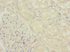 Immunohistochemistry of paraffin-embedded human kidney tissue using CSB-PA800100ESR2HU at dilution of 1:100