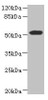 Western blot<br />
 All lanes: ASPSCR1 antibody at 8.71µg/ml + 293T whole cell lysate<br />
 Secondary<br />
 Goat polyclonal to rabbit IgG at 1/10000 dilution<br />
 Predicted band size: 61, 70, 55, 38 kDa<br />
 Observed band size: 61 kDa<br /> Western blot<br />
 All lanes: ASPSCR1 antibody at 8.71µg/ml + 293T whole cell lysate<br />
 Secondary<br />
 Goat polyclonal to rabbit IgG at 1/10000 dilution<br />
 Predicted band size: 61, 70, 55, 38 kDa<br />
 Observed band size: 61 kDa<br />