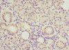 Immunohistochemistry of paraffin-embedded human pancreatic tissue using CSB-PA866328ESR2HU at dilution of 1:100