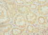 Immunohistochemistry of paraffin-embedded human kidney tissue using CSB-PA881016ESR2HU at dilution of 1:100