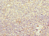 Immunohistochemistry of paraffin-embedded human spleen tissue using CSB-PA862061ESR1HU at dilution of 1:100