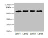 Western blot<br />
 All lanes: IL21R antibody at 2.18µg/ml<br />
 Lane 1: A549 whole cell lysate<br />
 Lane 2: Raji whole cell lysate<br />
 Lane 3: Colo320 whole cell lysate<br />
 Lane 4: K562 whole cell lysate<br />
 Secondary<br />
 Goat polyclonal to rabbit IgG at 1/10000 dilution<br />
 Predicted band size: 59 kDa<br />
 Observed band size: 59 kDa<br />