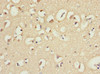Immunohistochemistry of paraffin-embedded human brain tissue using CSB-PA862061ESR2HU at dilution of 1:100