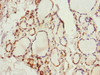 Immunohistochemistry of paraffin-embedded human thyroid tissue using CSB-PA012008DSR1HU at dilution of 1:100