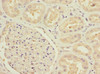 Immunohistochemistry of paraffin-embedded human kidney tissue using CSB-PA754385ESR2HU at dilution of 1:100