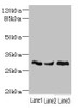 Western blot<br />
 All lanes: NDUFS3 antibody at 1.98µg/ml<br />
 Lane 1: Mouse brain tissue<br />
 Lane 2: Mouse skeletal muscle tissue<br />
 Lane 3: Mouse heart tissue<br />
 Secondary<br />
 Goat polyclonal to rabbit IgG at 1/10000 dilution<br />
 Predicted band size: 31, 15 kDa<br />
 Observed band size: 31 kDa<br />