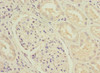 Immunohistochemistry of paraffin-embedded human kidney tissue using CSB-PA015662ESR1HU at dilution of 1:100