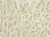 Immunohistochemistry of paraffin-embedded human heart tissue using CSB-PA015662ESR1HU at dilution of 1:100